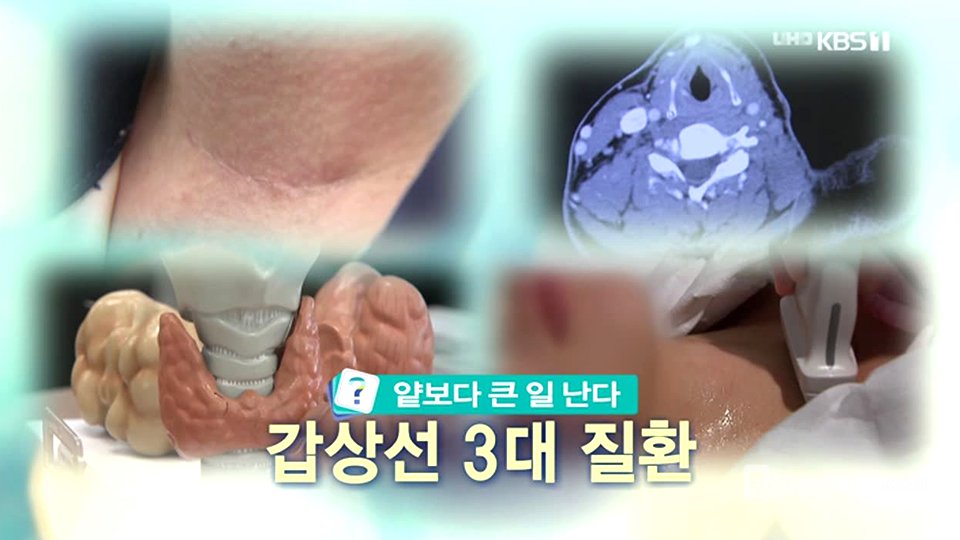 무엇이든 물어보세요 - KBS