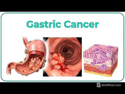 Gastric Cancer: Etiology, Risk Factors, Clinical features, Pathology, Diagnosis & Treatment - USMLE